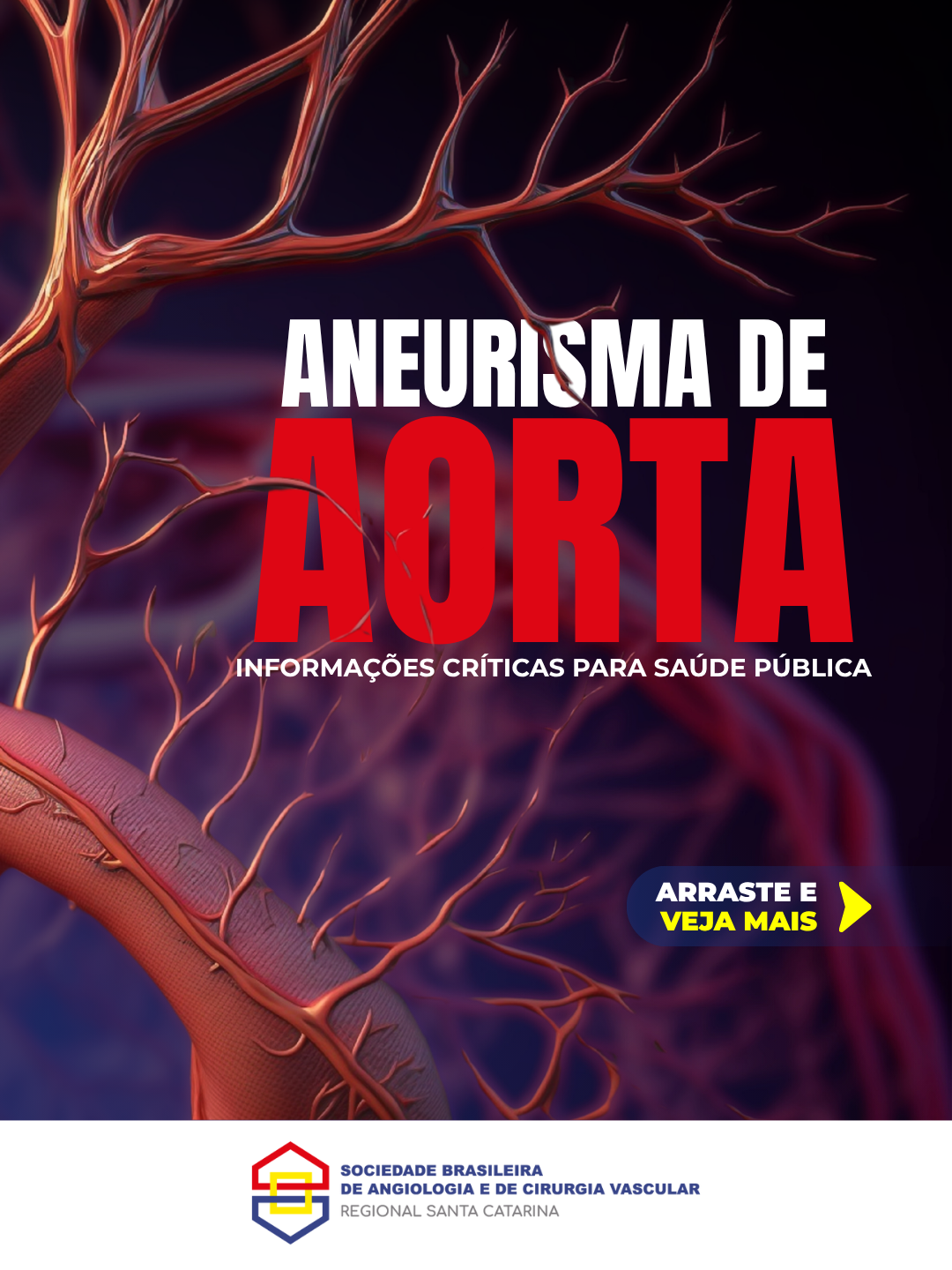 Aneurisma de Aorta: Informação Crítica para Saúde Pública