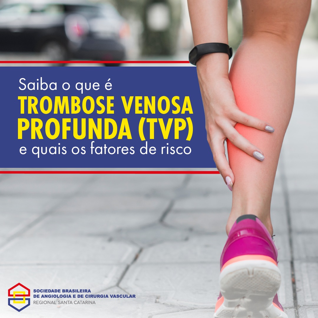 Trombose 21 De Julho